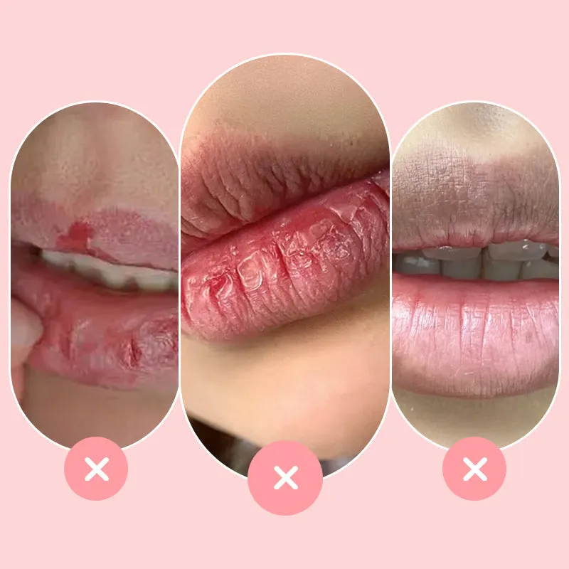 10g Ultra-Hydrating Lip Glowy Balm