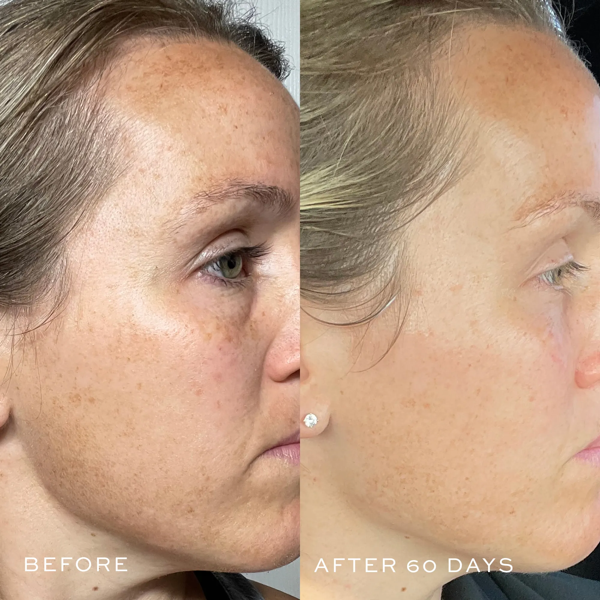TBT® Serum (Anti-Aging Serum)
